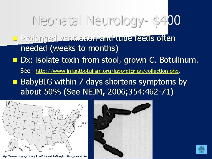 Neonatal Neurology- $400 Prolonged ventilation and tube feeds often needed (weeks to months) n