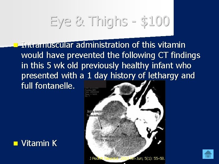 Eye & Thighs - $100 n Intramuscular administration of this vitamin would have prevented