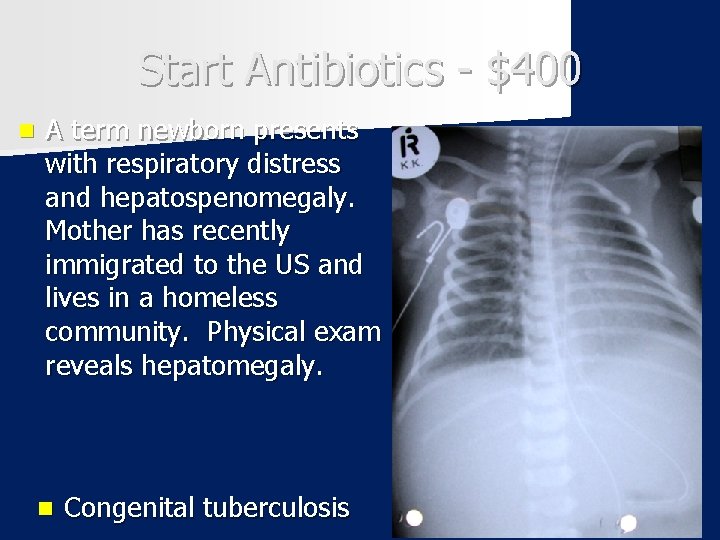 Start Antibiotics - $400 n A term newborn presents with respiratory distress and hepatospenomegaly.