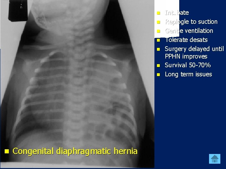 n n n n Congenital diaphragmatic hernia Intubate Replogle to suction Gentle ventilation Tolerate