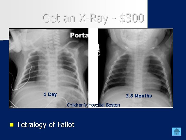 Get an X-Ray - $300 1 Day 3. 5 Months Children’s Hospital Boston n