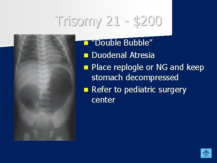 Trisomy 21 - $200 n n “Double Bubble” Duodenal Atresia Place replogle or NG