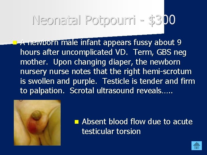 Neonatal Potpourri - $300 n A newborn male infant appears fussy about 9 hours