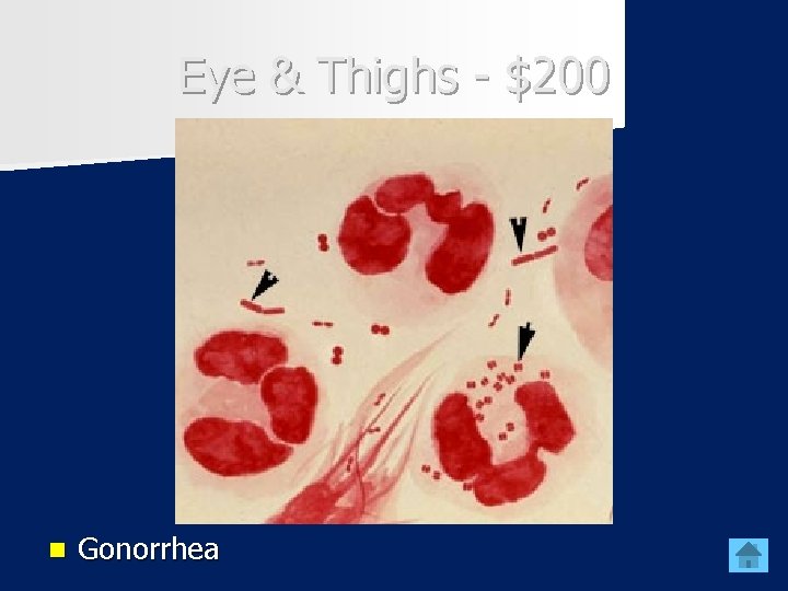 Eye & Thighs - $200 n Gonorrhea 