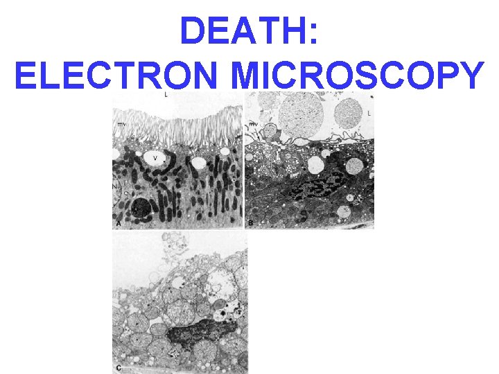 DEATH: ELECTRON MICROSCOPY 