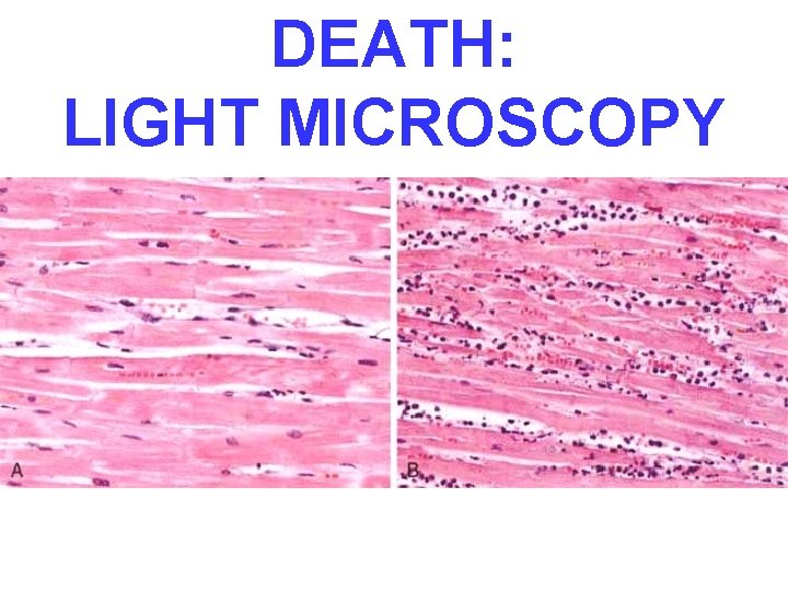 DEATH: LIGHT MICROSCOPY 