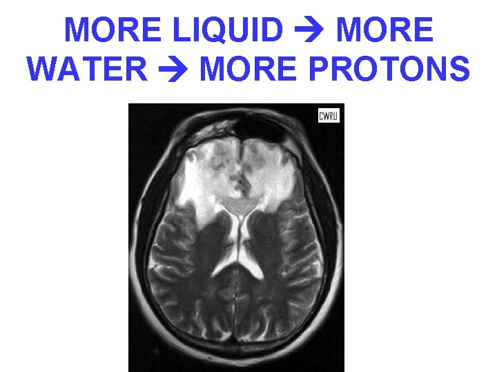 MORE LIQUID MORE WATER MORE PROTONS 