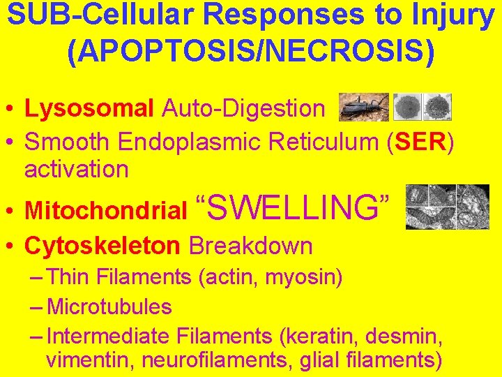 SUB-Cellular Responses to Injury (APOPTOSIS/NECROSIS) • Lysosomal Auto-Digestion • Smooth Endoplasmic Reticulum (SER) activation