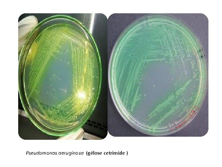 Pseudomonas aeruginosa (gélose cetrimide ) 