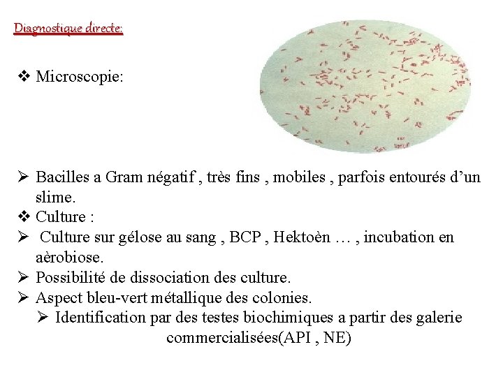 Diagnostique directe: v Microscopie: Ø Bacilles a Gram négatif , très fins , mobiles