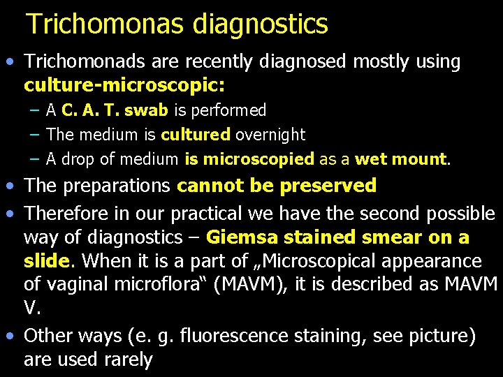 Trichomonas diagnostics • Trichomonads are recently diagnosed mostly using culture-microscopic: – A C. A.