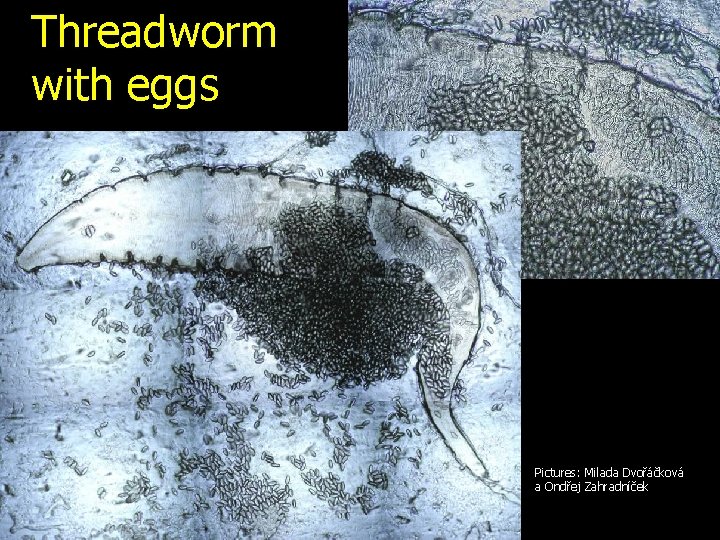 Threadworm with eggs Pictures: Milada Dvořáčková a Ondřej Zahradníček 