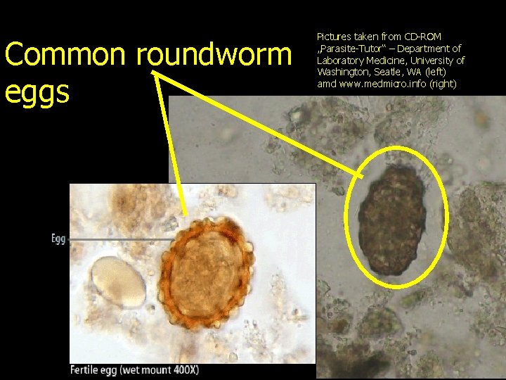 Common roundworm eggs Pictures taken from CD-ROM „Parasite-Tutor“ – Department of Laboratory Medicine, University