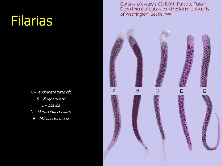 Filarias A – Wuchereria bancrofti B – Brugia malayi C – Loa loa D