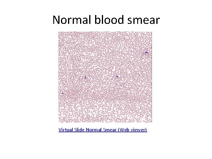 Normal blood smear Virtual Slide Normal Smear (Web viewer) 