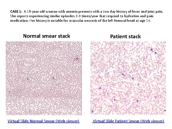 CASE 1: A 19 -year-old woman with anemia presents with a two day history