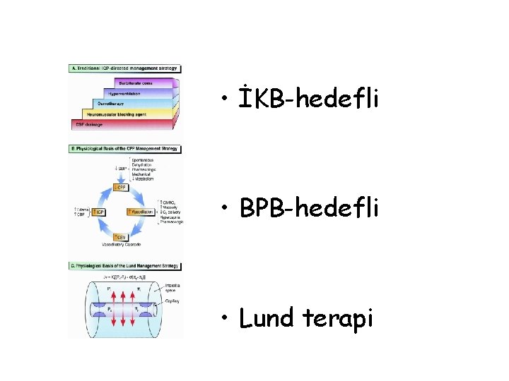  • İKB-hedefli • BPB-hedefli • Lund terapi 