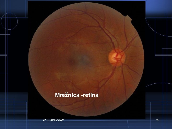 Mrežnica -retina 27 November 2020 15 