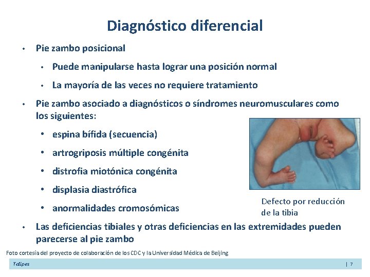 Diagnóstico diferencial • • Pie zambo posicional • Puede manipularse hasta lograr una posición