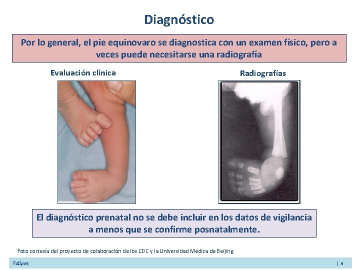 Diagnóstico Por lo general, el pie equinovaro se diagnostica con un examen físico, pero