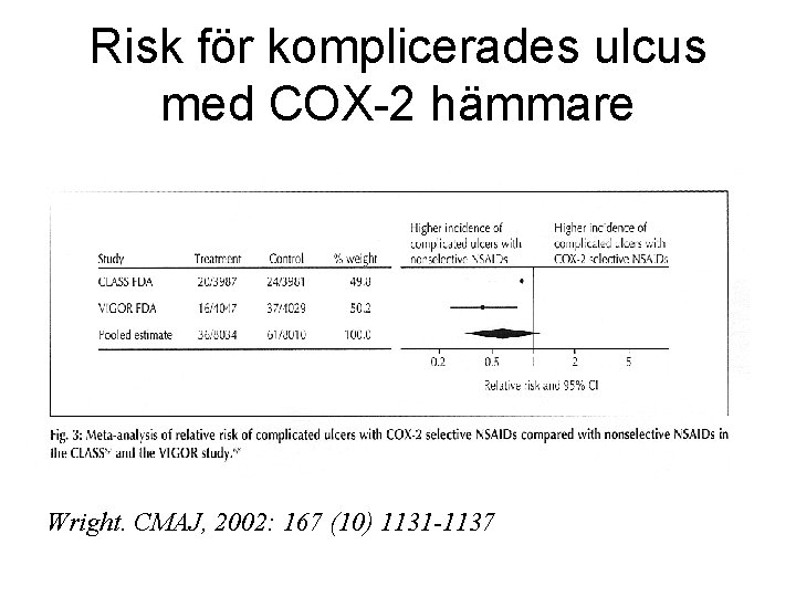 Risk för komplicerades ulcus med COX-2 hämmare Wright. CMAJ, 2002: 167 (10) 1131 -1137