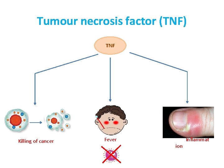 Tumour necrosis factor (TNF) TNF Killing of cancer Fever Inflammat ion 
