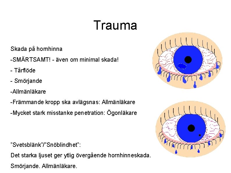 Trauma Skada på hornhinna -SMÄRTSAMT! - även om minimal skada! - Tårflöde - Smörjande