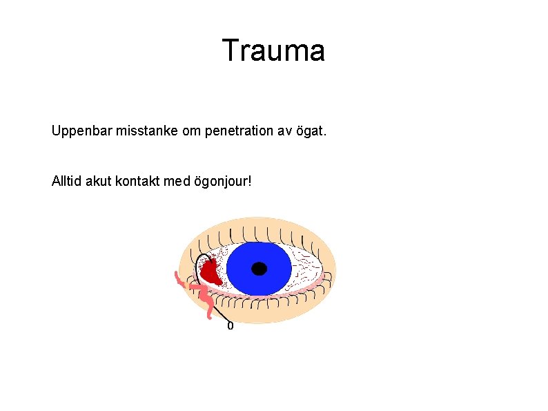 Trauma Uppenbar misstanke om penetration av ögat. Alltid akut kontakt med ögonjour! 