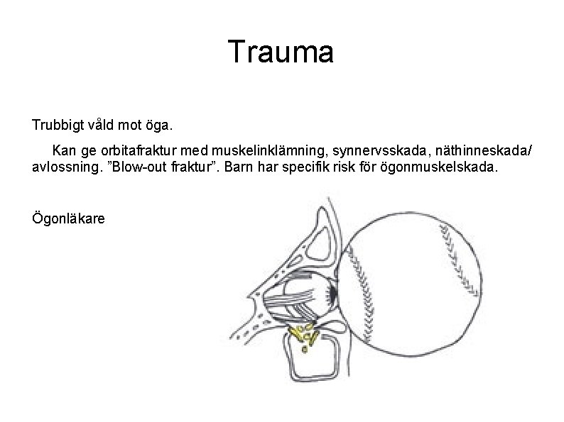 Trauma Trubbigt våld mot öga. Kan ge orbitafraktur med muskelinklämning, synnervsskada, näthinneskada/ avlossning. ”Blow-out