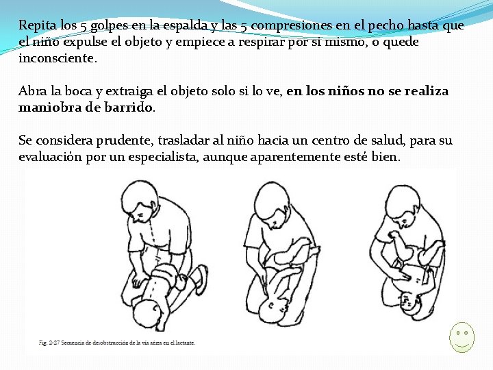 Repita los 5 golpes en la espalda y las 5 compresiones en el pecho