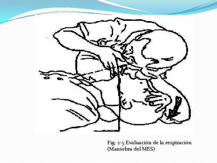 Fig. 2 -5 Evaluación de la respiración (Maniobra del MES) 