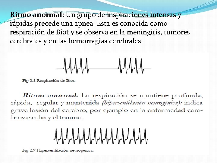 Ritmo anormal: Un grupo de inspiraciones intensas y rápidas precede una apnea. Esta es