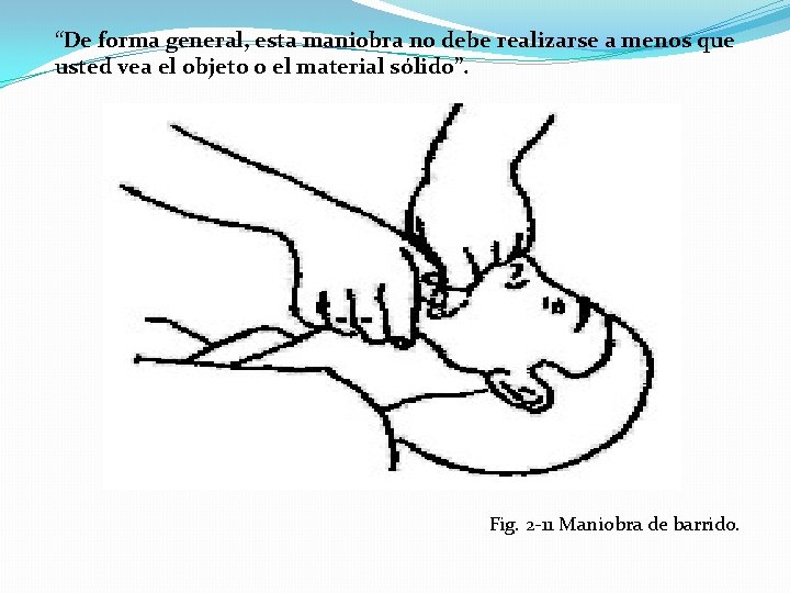 “De forma general, esta maniobra no debe realizarse a menos que usted vea el