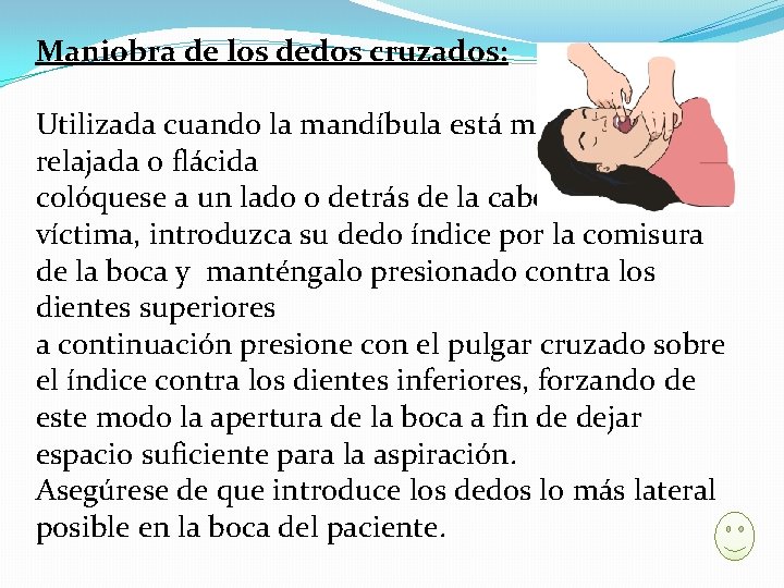 Maniobra de los dedos cruzados: Utilizada cuando la mandíbula está moderadamente relajada o flácida