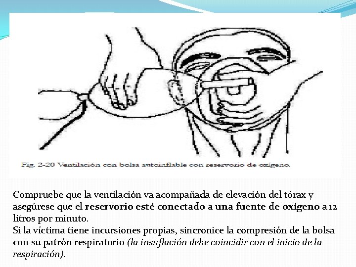 Compruebe que la ventilación va acompañada de elevación del tórax y asegúrese que el