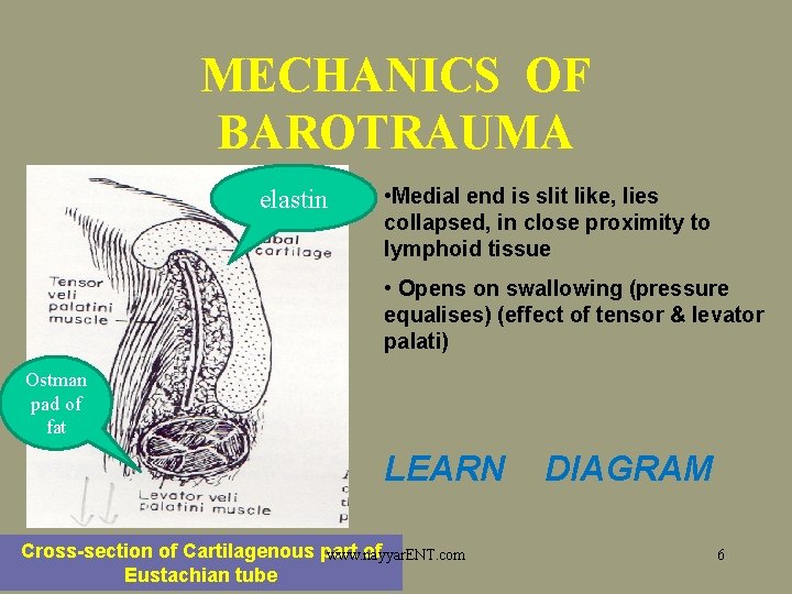 OTITIC BAROTRAUMA Aerootitis media Aviation pressure deafness 1783