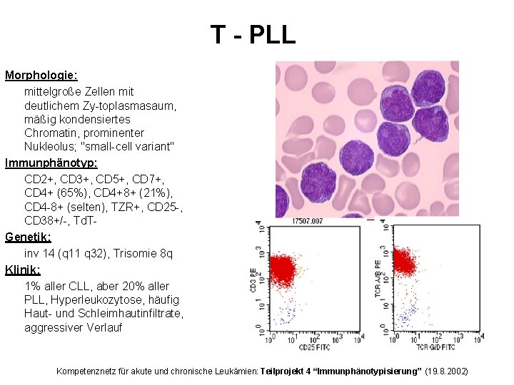 T - PLL Morphologie: mittelgroße Zellen mit deutlichem Zy-toplasmasaum, mäßig kondensiertes Chromatin, prominenter Nukleolus;
