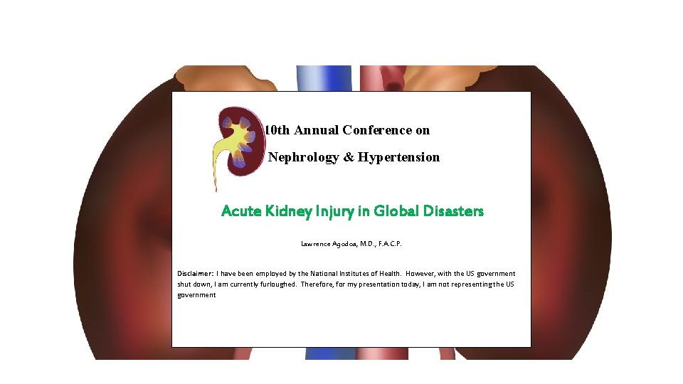  10 th Annual Conference on Nephrology & Hypertension Acute Kidney Injury in Global