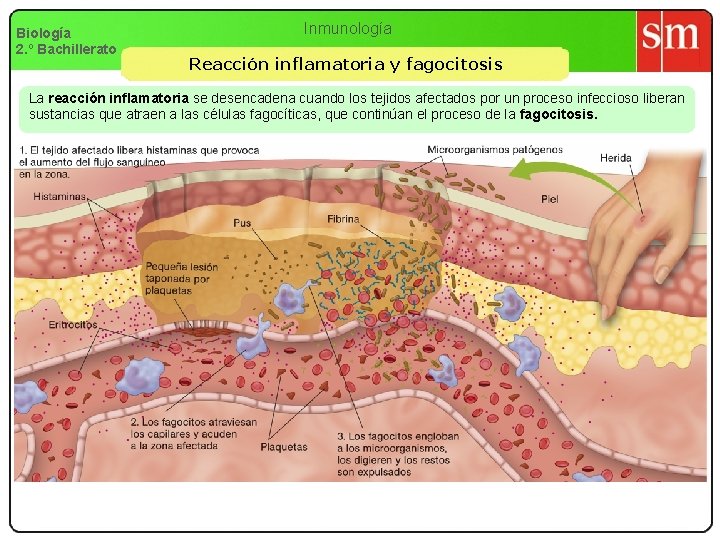 Biología 2. º Bachillerato Inmunología Reacción inflamatoria y fagocitosis La reacción inflamatoria se desencadena