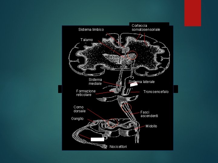 Corteccia somatosensoriale Sistema limbico Talamo Sistema mediale Sistema laterale Formazione reticolare Troncoencefalo Corno dorsale