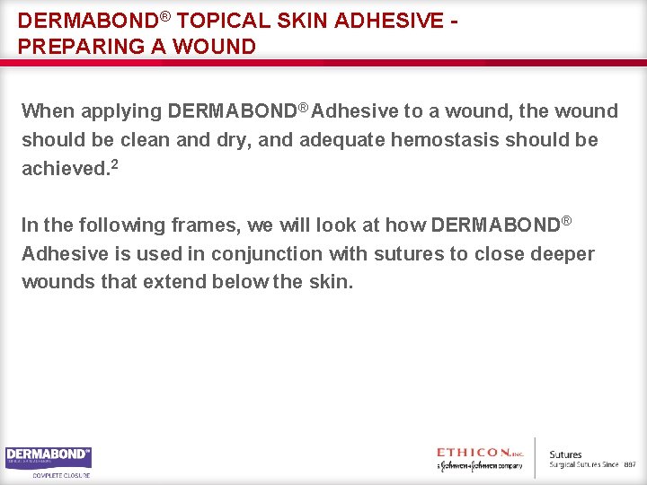 DERMABOND® TOPICAL SKIN ADHESIVE PREPARING A WOUND When applying DERMABOND® Adhesive to a wound,