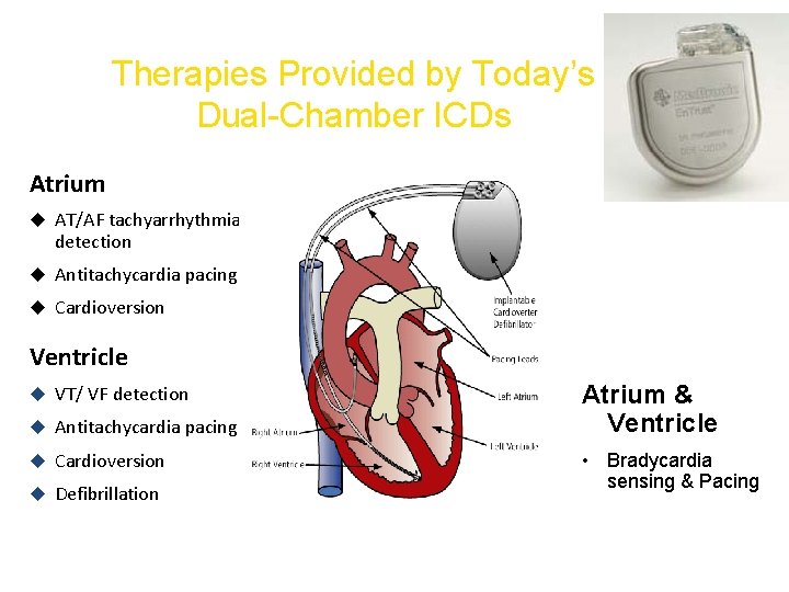 Therapies Provided by Today’s Dual-Chamber ICDs Atrium AT/AF tachyarrhythmia detection Antitachycardia pacing Cardioversion Ventricle