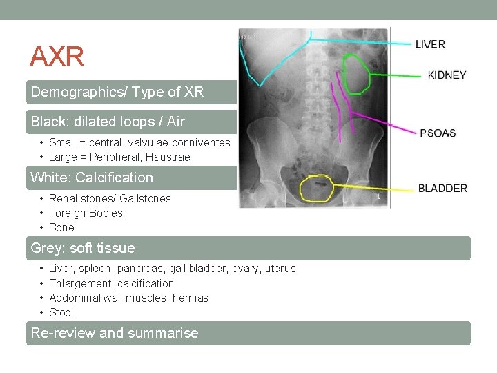 AXR Demographics/ Type of XR Black: dilated loops / Air • Small = central,