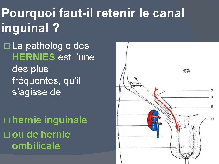 Pourquoi faut-il retenir le canal inguinal ? � La pathologie des HERNIES est l’une