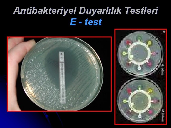 Antibakteriyel Duyarlılık Testleri E - test 