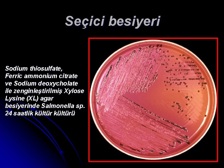 Seçici besiyeri Sodium thiosulfate, Ferric ammonium citrate ve Sodium deoxycholate ile zenginleştirilmiş Xylose Lysine