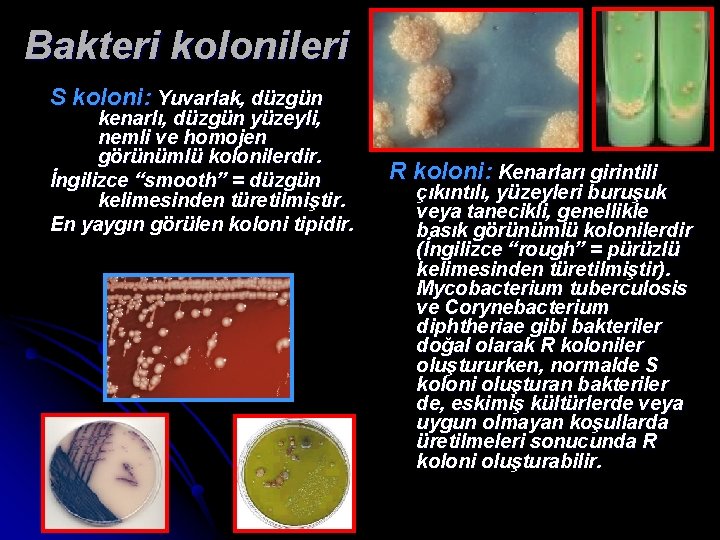 Bakteri kolonileri S koloni: Yuvarlak, düzgün kenarlı, düzgün yüzeyli, nemli ve homojen görünümlü kolonilerdir.