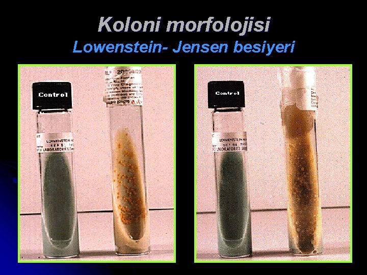 Koloni morfolojisi Lowenstein- Jensen besiyeri 