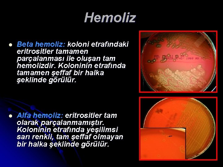 Hemoliz l Beta hemoliz: koloni etrafındaki eritrositler tamamen parçalanması ile oluşan tam hemolizdir. Koloninin