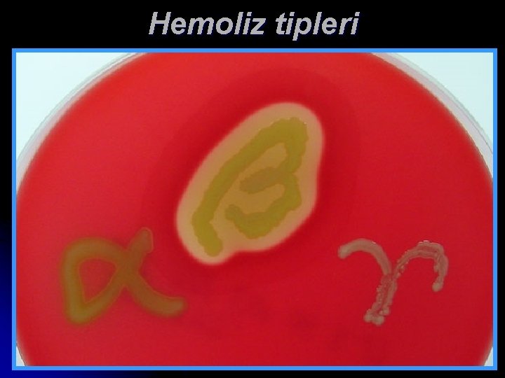 Hemoliz tipleri 